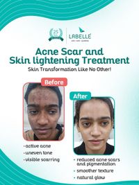 Advanced Skin & Facial Treatments