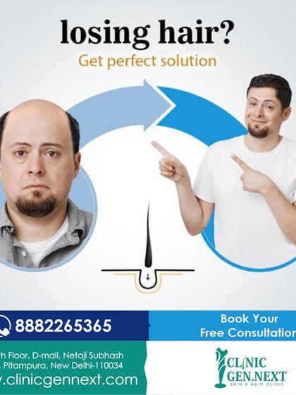 Losing hair? I provide the perfect solution with advanced hair transplant techniques that deliver natural and permanent results.