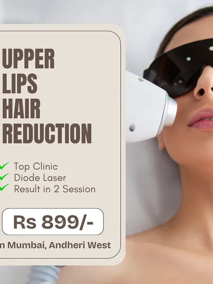 Getting started with laser hair reduction can be easy and affordable. We offer targeted treatments like this one for the upper lips, using our advanced Diode laser to deliver visible results in just a couple of sessions, making it a perfect introduction to a hair-free life.