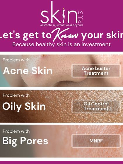 Acne, Pores & Scar Correction photo 3