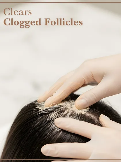 Healthy hair starts with a healthy scalp. This image shows the application of our professional scalp exfoliation treatment, designed to clear clogged follicles from product buildup and excess oil.