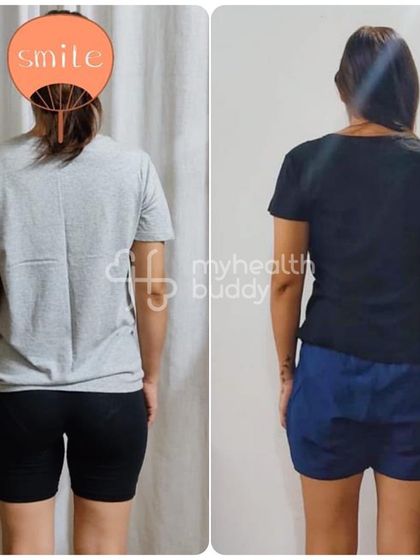 The back view of the same client's DR transformation, showing a more toned and defined back.