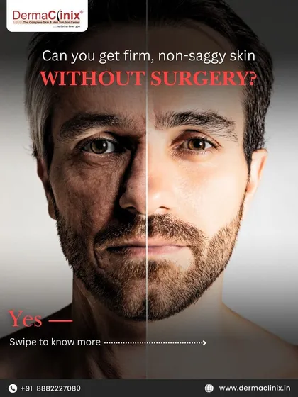 This visual demonstrates the transformative effect of our non-surgical anti-aging treatments. We can achieve firm, lifted skin by combining advanced technologies like RF Microneedling and HIFU with injectables to boost natural collagen and restore youthful contours.