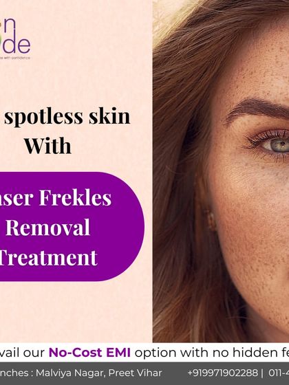 If you're concerned about freckles, our laser freckle removal treatment can help. It targets the melanin in the spots to give you clearer, more even-toned skin.