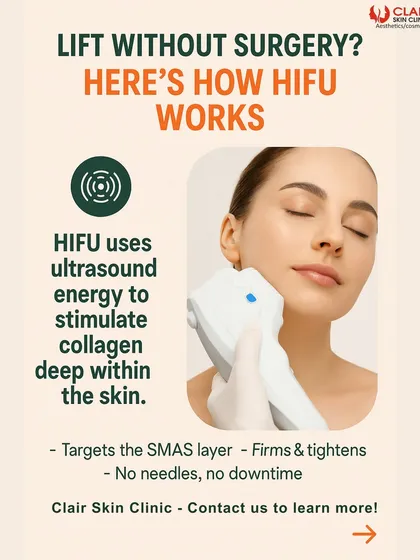 How does HIFU work? This graphic explains the science. Ultrasound energy is used to stimulate collagen deep within the skin's foundational SMAS layer, resulting in firming and tightening from the inside out, all without needles.