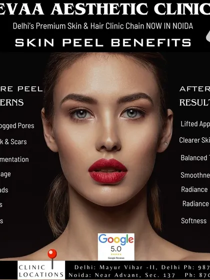 A comprehensive look at the concerns a skin peel can address (before) and the results you can expect (after), from clearer skin to improved radiance and softness.