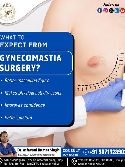 Wondering what to expect from gynecomastia surgery? The primary outcomes are a more masculine figure and improved confidence. It also makes physical activity more comfortable and can even help improve your posture.