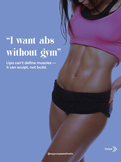 Many people believe liposuction can create defined abs. However, lipo only removes the layer of fat on top of the muscles. It can reveal your abs, but it cannot build them.