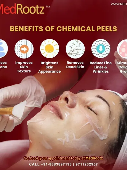 A chemical peel works by applying a solution that removes damaged skin cells. This process stimulates collagen growth and promotes the growth of new, healthy skin, which helps balance tone and brighten your appearance.