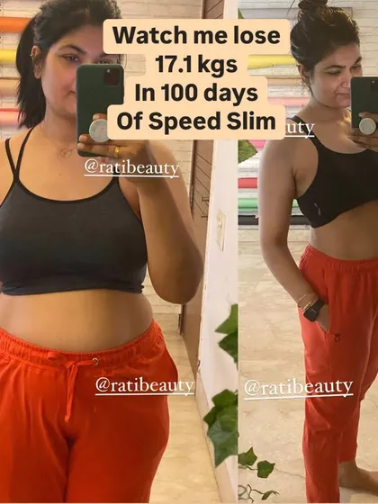 A side-by-side look at my 100-day progress. This shows the real, visible reduction in belly fat and overall toning, achieved just with Speed Slim and walking.