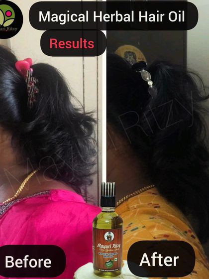 A clear before and after result from a customer using my Magical Herbal Hair Oil. You can see the improved thickness and texture of the hair, showing the power of consistent, natural care.