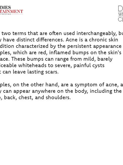 A snippet from my Times Entertainment article, clarifying that pimples are a symptom of the chronic skin condition known as acne.