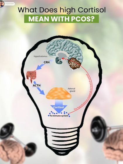 High cortisol, the stress hormone, can worsen PCOS symptoms. This graphic explains the connection between the adrenal gland, cortisol, and the immune system.