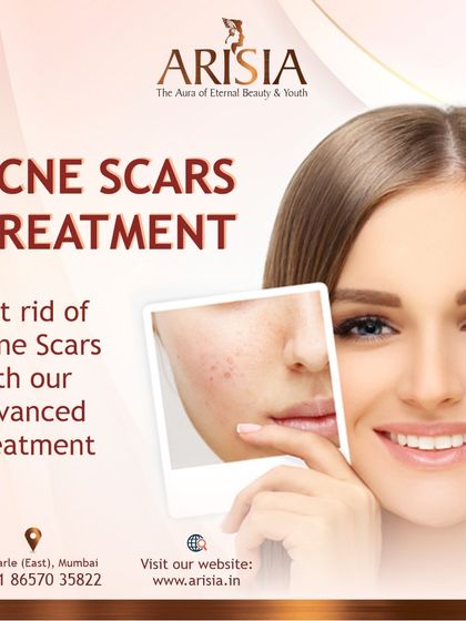 Don't let acne scars define your skin. With our advanced treatments, we can help you achieve a smoother, clearer complexion you'll love to show off.