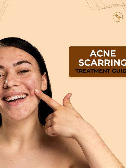 Our comprehensive treatment guide for acne scarring. Understanding your scars is the first step towards finding the most effective solution for your skin.