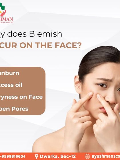 This graphic explains common causes of facial blemishes, such as sunburn, excess oil, and open pores. Understanding these factors helps in creating an effective treatment plan.