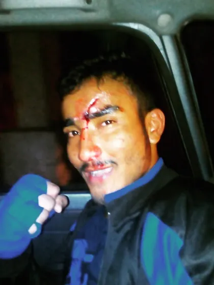 A throwback to after a 6-round pro kickboxing war. Battered but smiling. This is the life of a fighter.