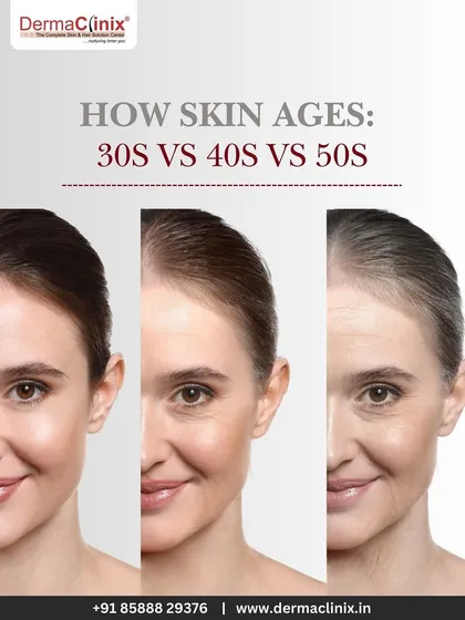 A visual representation of how skin ages through the decades. We offer tailored treatments to address the specific concerns that arise in your 30s, 40s, and 50s.