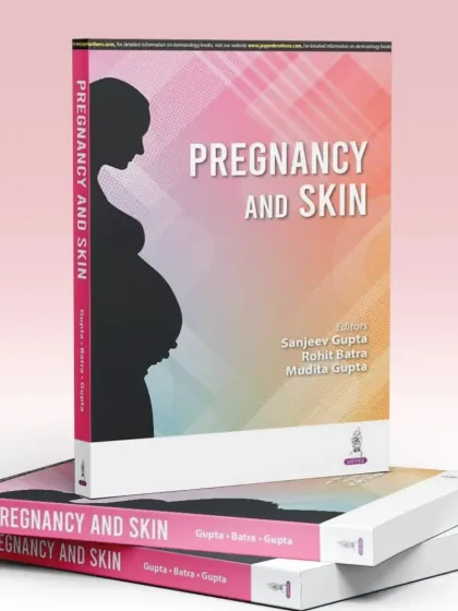 Skin changes during pregnancy are common and require special consideration. I co-edited "Pregnancy and Skin" to provide a safe and effective guide for managing dermatological issues during this sensitive time.