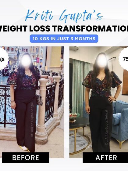 Kriti's before and after photos show a fantastic 10 kg weight loss in just 3 months, from 85 kgs to 75 kgs. Her dedication to the personalized weight loss plan delivered these amazing results.