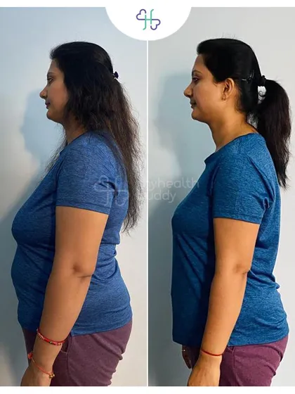 Rashmi's side profile shows the incredible progress she made. Her story is a powerful example for mothers who feel stuck after gaining weight during pregnancy.
