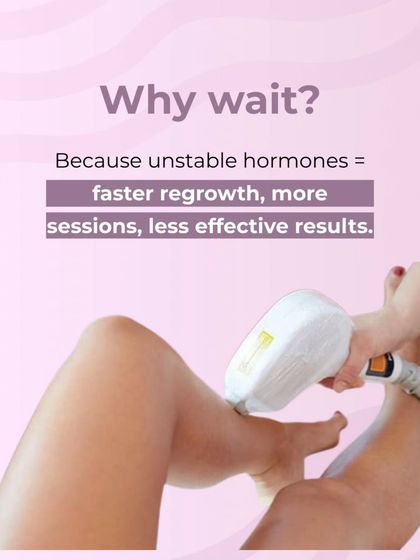 Why wait? Because treating with laser when hormones are unstable can lead to faster regrowth, requiring more sessions with less effective results. Patience is key.