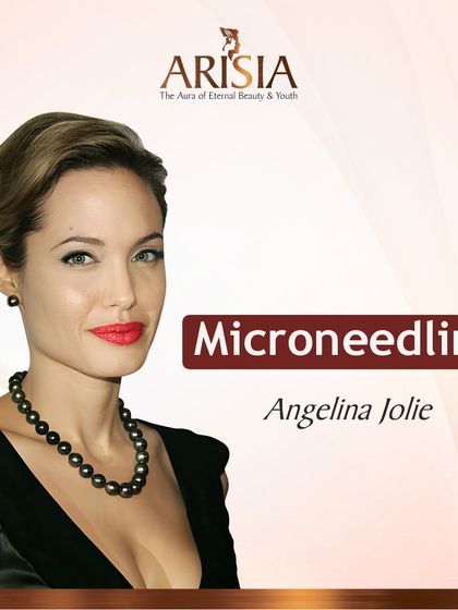 Even stars like Angelina Jolie rely on treatments like microneedling to maintain their flawless skin. It is an excellent method for building collagen and treating acne scars.