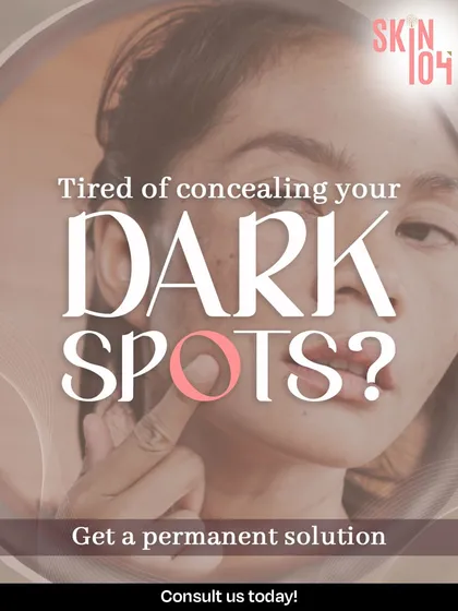 Tired of concealing dark spots every day? We offer permanent solutions to treat hyperpigmentation at its source, so you can stop hiding your skin and let it glow effortlessly.