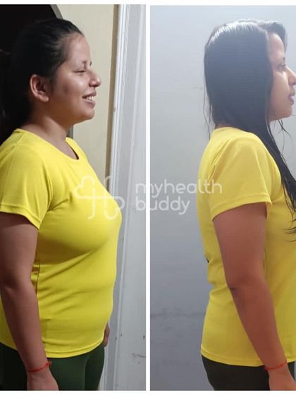 Side view of Neha's 8kg transformation.