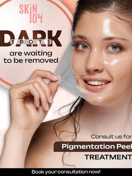 Those dark spots left behind by acne are waiting to be removed. Our specialized Pigmentation Peel Treatment is designed to lift these post-inflammatory marks, revealing clearer and more even skin.