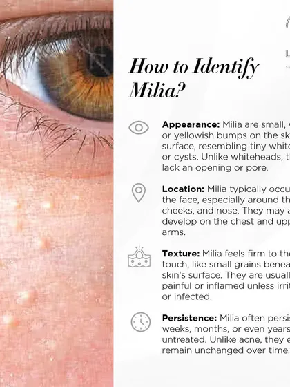 Knowledge is the first step to clear skin. Many people confuse milia with other skin issues. This guide helps you identify milia by their appearance, location, and texture, so you know what you are dealing with.