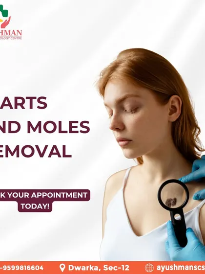 Say goodbye to unwanted warts and moles with my professional removal services. Book an appointment for a safe and effective treatment to achieve clearer skin.