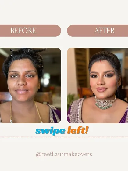 This before-and-after shows the power of color correction and camouflage on skin with discoloration. I teach how to neutralize pigmentation and create an even, glowing base.