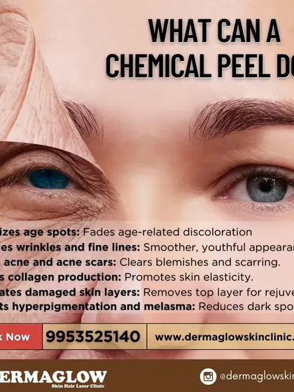 A chemical peel is a versatile treatment that addresses multiple skin concerns at once. This visual explains how the procedure works to minimize age spots, reduce fine lines, treat acne and scarring, and boost collagen. It is a powerful tool for comprehensive skin rejuvenation.