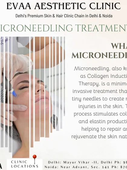What is Microneedling? This educational graphic explains Collagen Induction Therapy, a minimally invasive treatment that uses tiny needles to stimulate natural skin repair and rejuvenation.