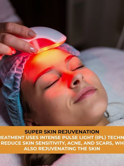 Super Skin Rejuvenation (SSR) uses Intense Pulsed Light (IPL) technology to address skin concerns. It is effective in reducing skin sensitivity, acne, and scars, while simultaneously rejuvenating the skin for a healthier appearance.