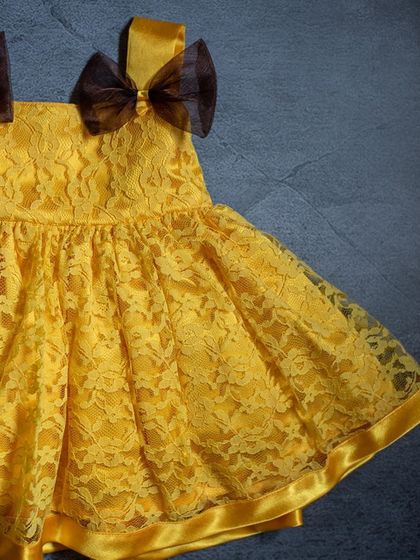 A close-up of a vibrant yellow lace dress. The delicate lace overlay and the contrasting brown bows on the shoulders make this a perfect summer party dress.