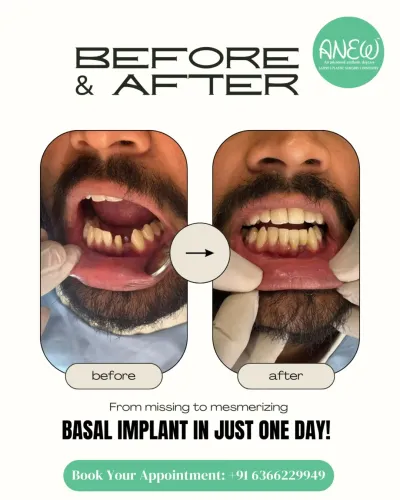 Cosmetic Dentistry