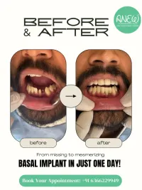 Cosmetic Dentistry