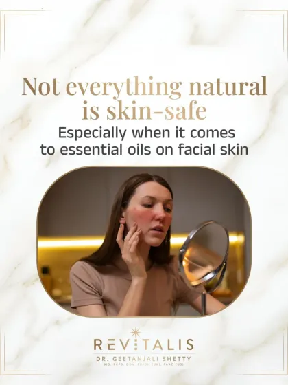 Not Everything Natural is Skin-Safe, Especially Essential Oils. This carousel opener debunks the myth that "natural" equals "safe." I often see patients with burns and breakouts from using undiluted essential oils on their faces.