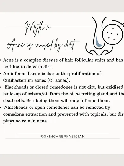 Myth 3: Acne is caused by dirt. This is incorrect. Acne is a complex disease of the hair follicle, and blackheads are oxidized oil and dead skin cells, not dirt. Over-scrubbing will only cause more inflammation.