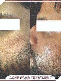 Advanced Facials & Skin Treatments