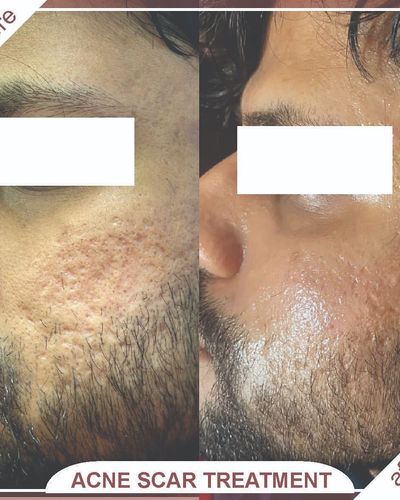 Advanced Facials & Skin Treatments