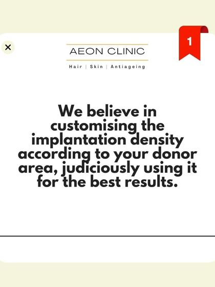 Why choose us? We customize the implantation density according to your specific donor area, using it judiciously to achieve the best possible results for you.