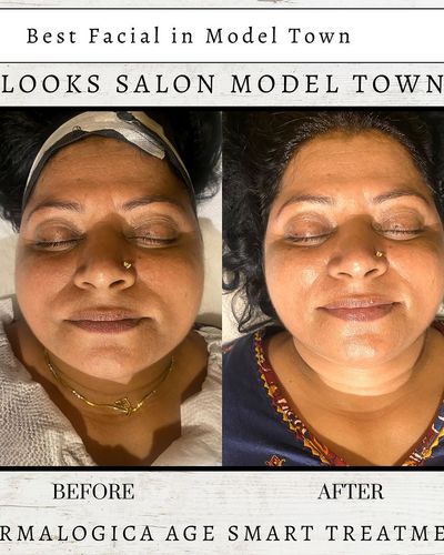 Skincare Treatments