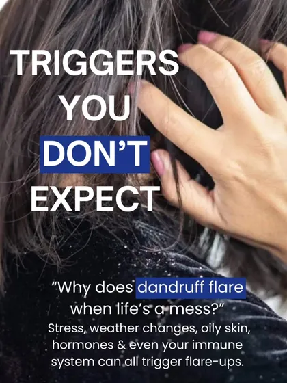 Dandruff flare-ups can be triggered by things you might not expect, like stress, hormonal shifts, and changes in weather. Managing these triggers is part of my comprehensive treatment approach.