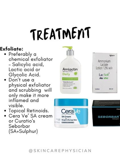 Chemical exfoliants containing salicylic, lactic, or glycolic acid are key to treatment. I advise against physical scrubs, which can cause more inflammation and redness.