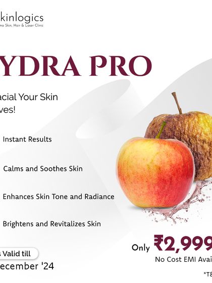 Introducing the Hydra Pro facial, the treatment your skin deserves. This graphic highlights its benefits, including instant results, calming effects, and enhanced skin tone, available at a special introductory price.