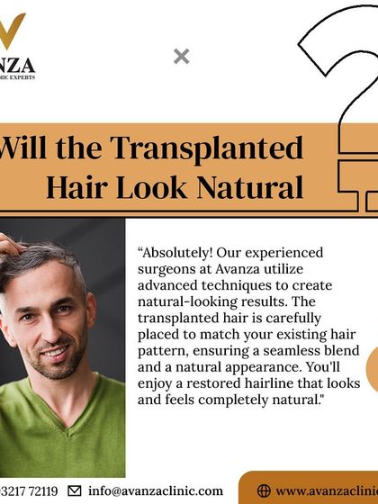 Will the transplanted hair look natural? Absolutely. Our experienced surgeons use advanced techniques to place hair that matches your existing hair pattern, ensuring a seamless and completely natural appearance.