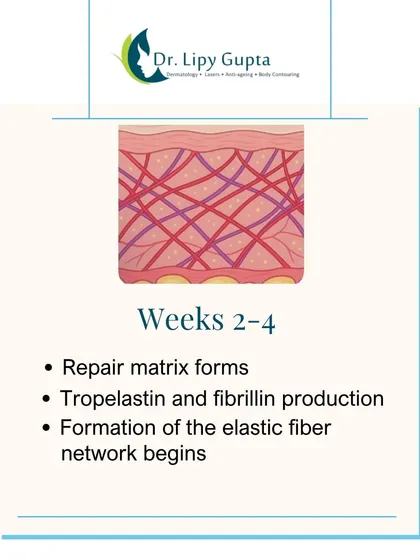 During weeks 2 to 4, a repair matrix forms and the foundation for a new, strong elastic fiber network is built, improving your skin's resilience.